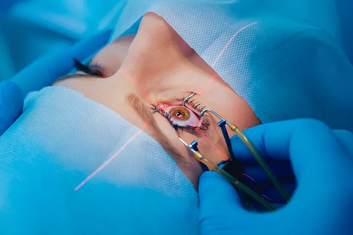 Laser vision correction being performed on a patient’s eye