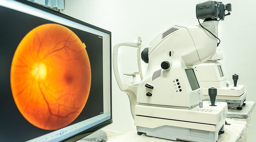 Retinal scan displayed on a screen beside a fundus camera
